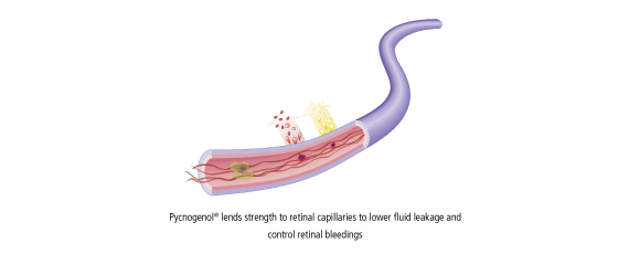 Pycnogenol lends strength to retinal capillaries